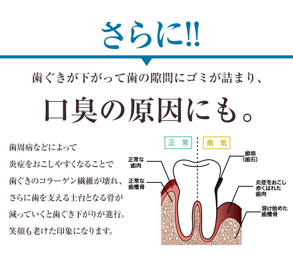 口臭の原因にも